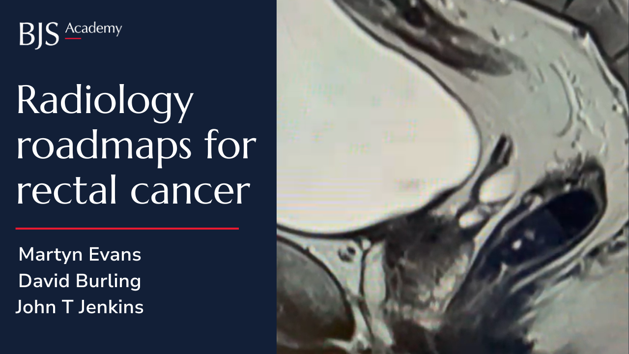 Radiology roadmaps for rectal cancer