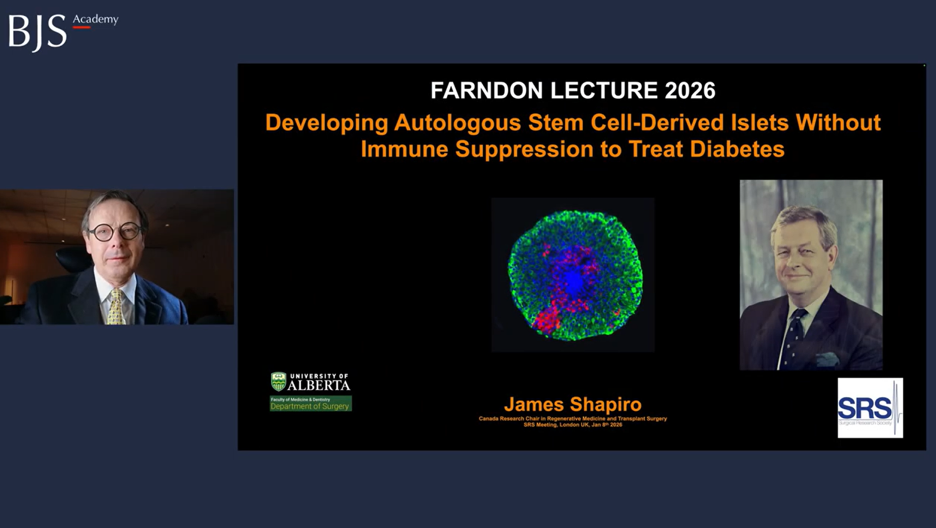 Developing autologous stem cell-derived islets without immune suppression to treat diabetes