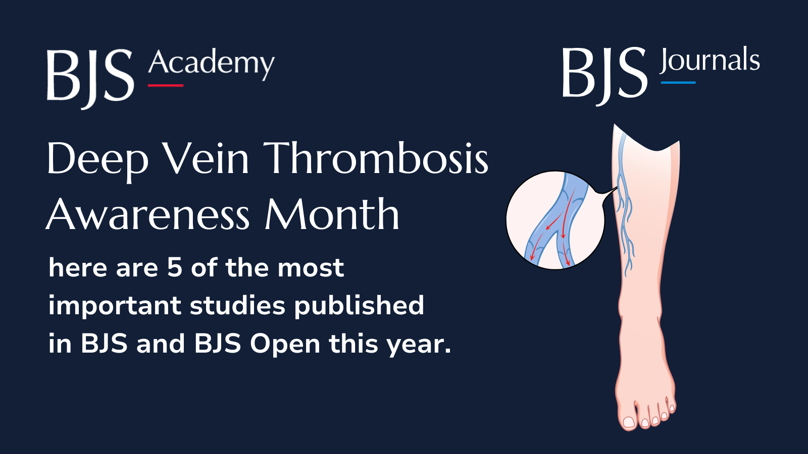 Deep vein thrombosis awareness month 2026