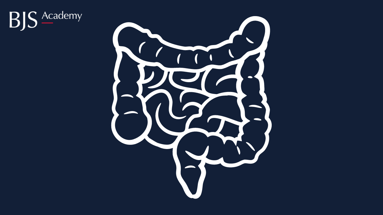 Personalised surgery for the colon cancer patients: new frontiers