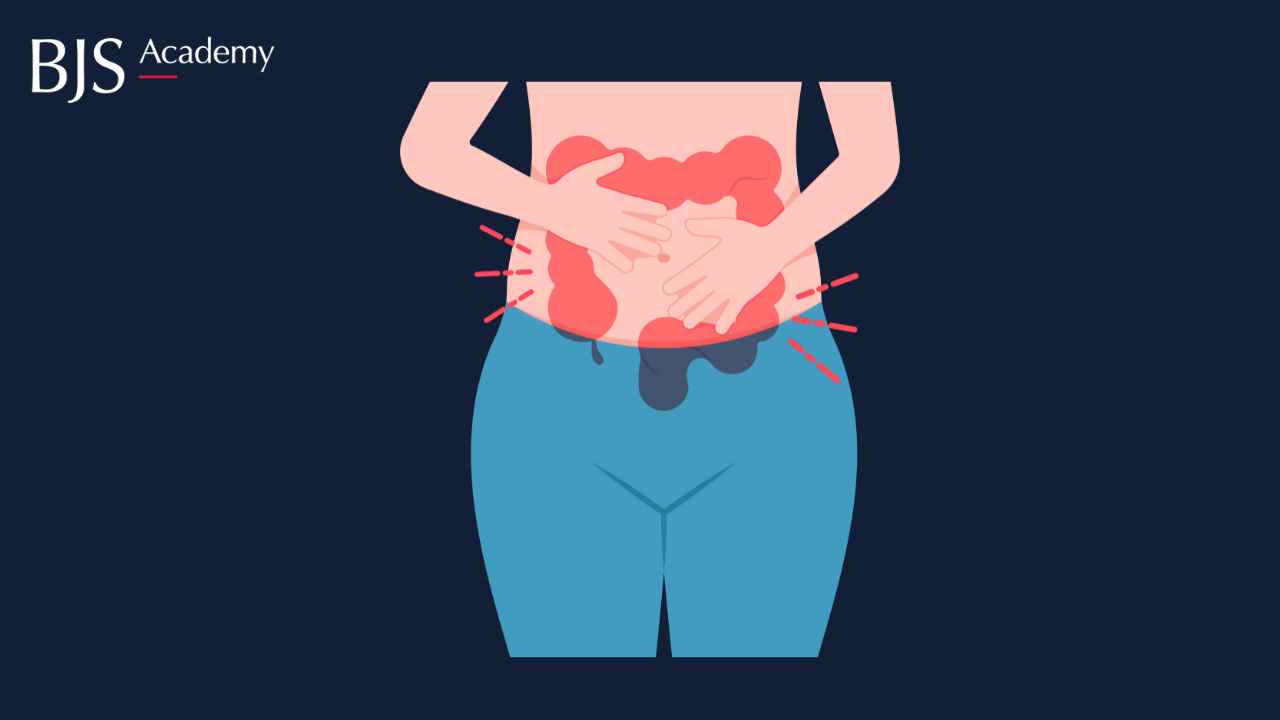 Creeping fat.