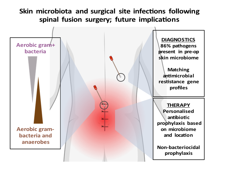 Review of: Contribution of the patient microbiome to surgical site infection and antibiotic prophylaxis failure in spine surgery