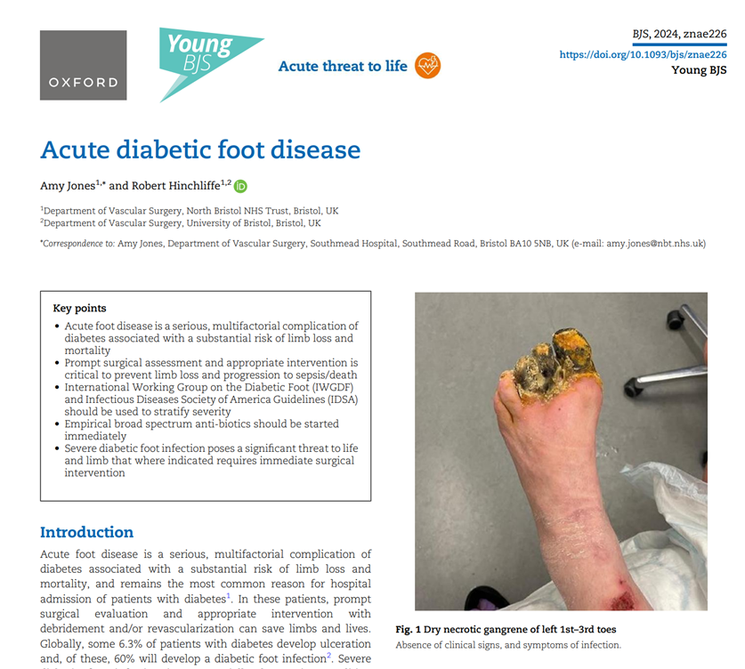 Acute diabetic foot disease